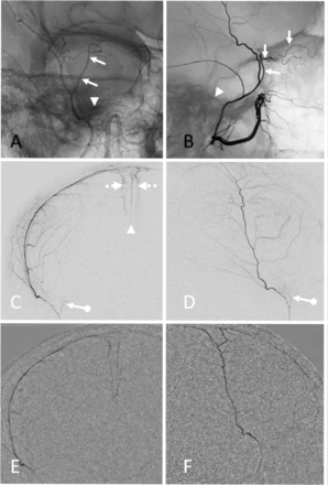 Figure 13